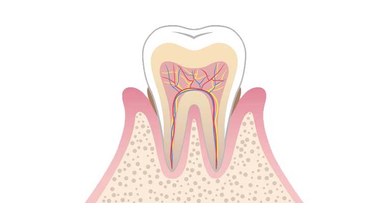軽度歯周病
