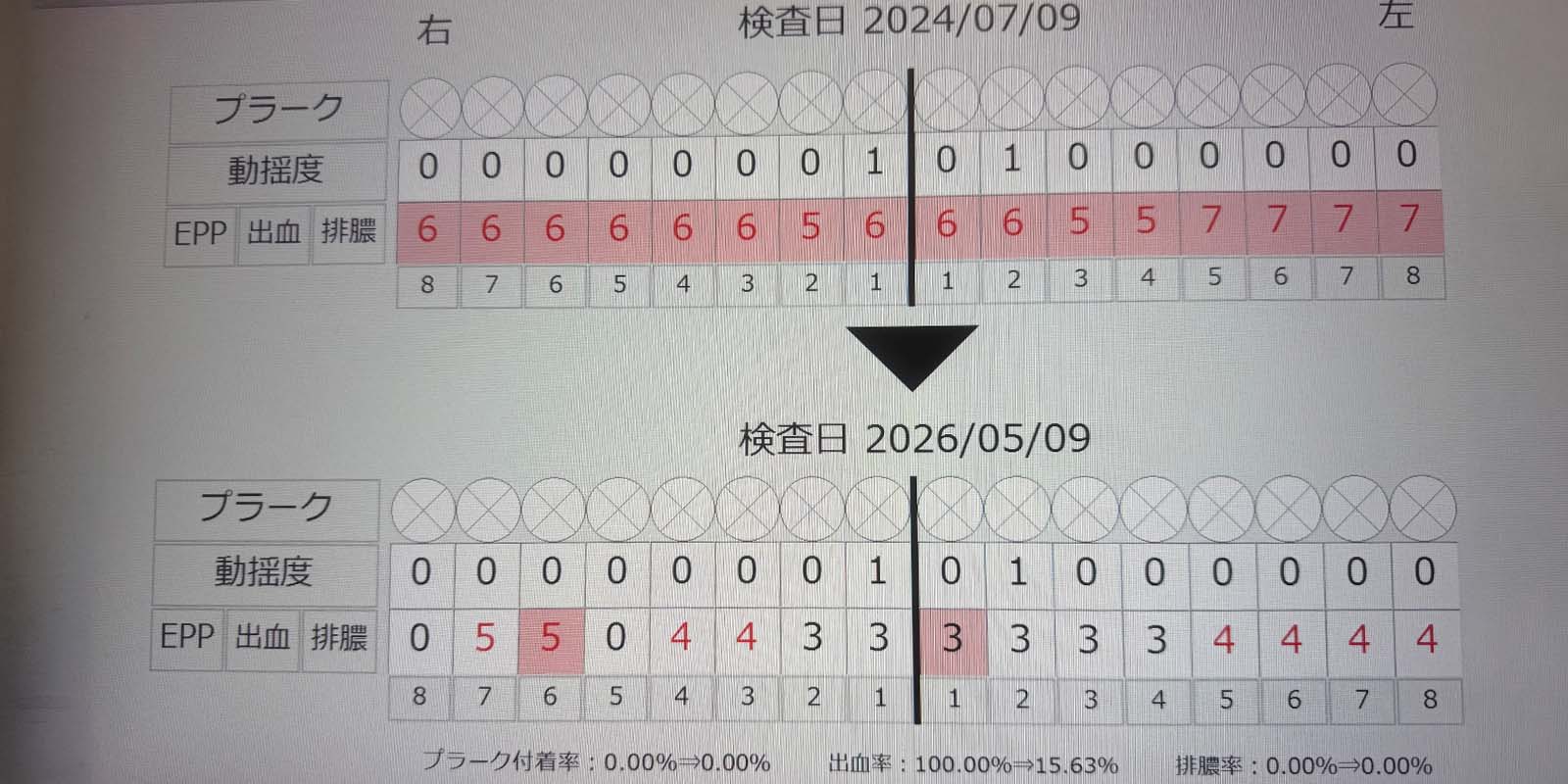 症例：50代男性（治療期間：約2年）